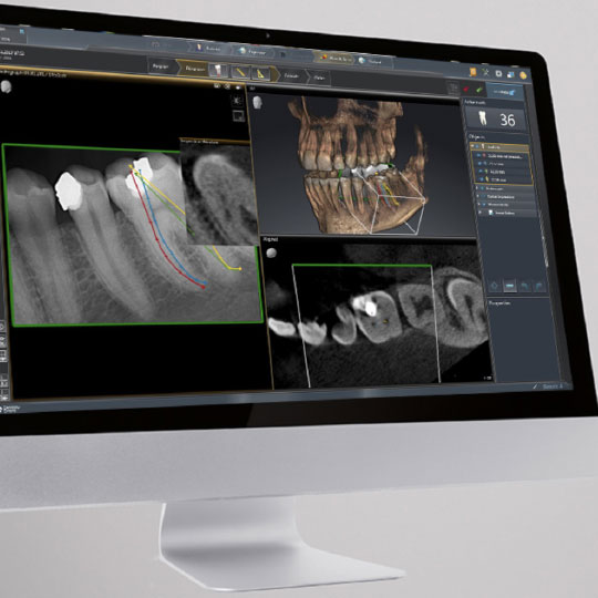 3D Röntgen (DVT) zahnarzt